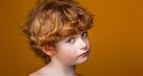 Freckles What Causes Them And How Can You Treat Them Particle
