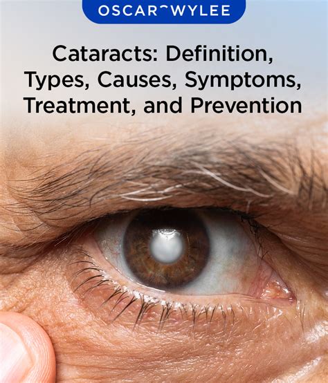 Cataracts Definition Types Causes Symptoms Treatment And Prevention