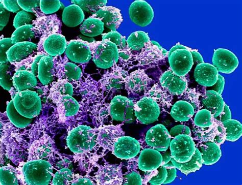 Staphylococcus Epidermidis Biofilms And Antibiotic Resistance Owlcation