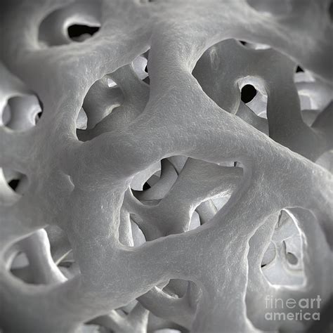 Cancellous Bone Photograph By Science Picture Co