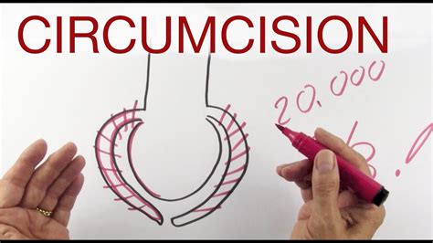 Circumcision Explained By Hans Wilhelm Youtube