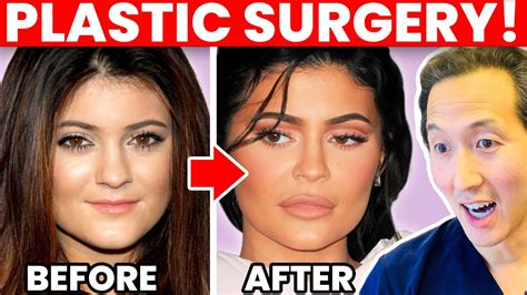 Plastic Surgeon Reacts To Kylie Jenner Cosmetic Surgery Transformation