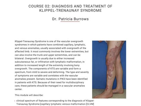 Course 02 Diagnosis And Treatment Of Klippel Trenaunay Syndrome The