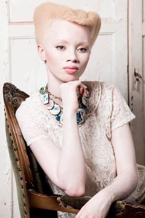 Albino Women And Girls With Gorgeous Natural Hair Gallery