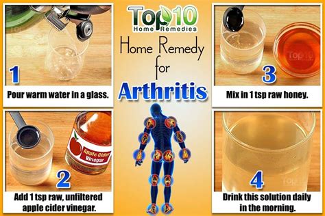 Home Remedies For Arthritis Top 10 Home Remedies