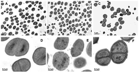 Morphology Of S Epidermidis 1457Δlytsr Under Transmission Electron