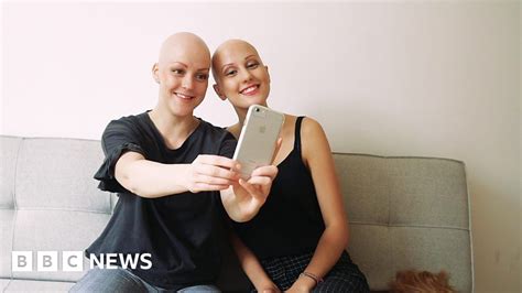 Nichola Has Created An App To Help Others With Alopecia Meet New