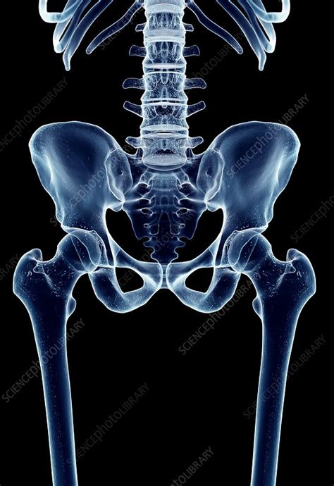 Human Hip Joint Stock Image F0163291 Science Photo Library
