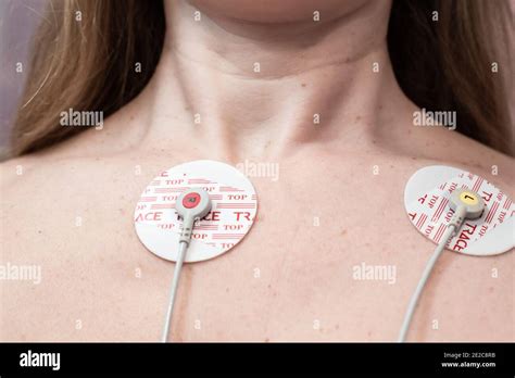 Electrodes Chest Hi Res Stock Photography And Images Alamy