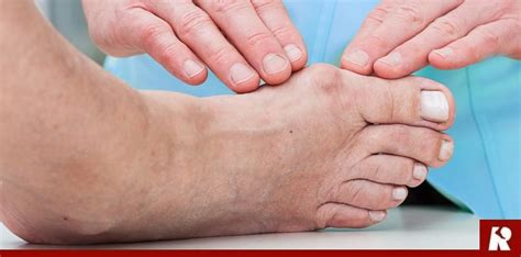 The Best Explanation For Hallux Rigidus Pain And Stiffness In Big Toe