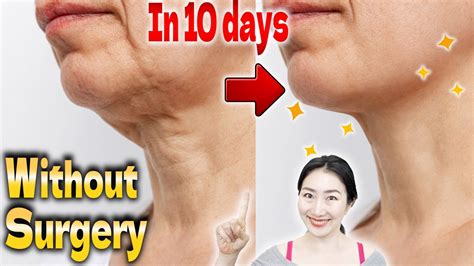 Lift Turkey Neck Without Surgery In 10 Days Ultimate Massage For Neck
