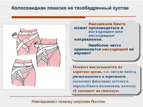 Фиксация перевязочного материала на шее и затылке. Санкт-Петербургский учебно-методический центр по ГОЧС и ПБ ...