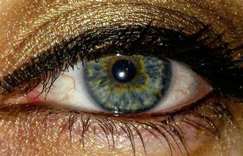 I Have Central Heterochromia Blue Grey Eyes With Yellow Starburst And