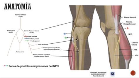 Figure From Estudio Por Imagen De La Neuropatia Del Nervio Peroneo