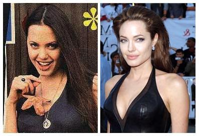 Plastic Surgery Before And After Angelina Jolie Plastic Surgery