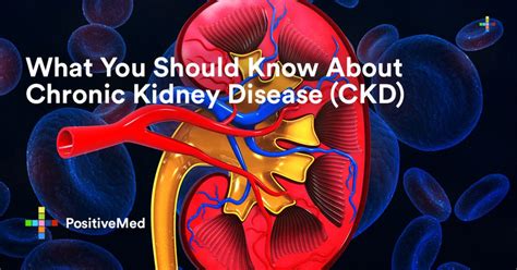 What You Should Know About Chronic Kidney Disease Ckd