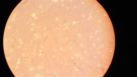 Ulva Reproductive Cells Youtube