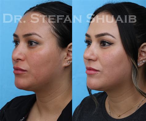 30 Dallas Facial Plastic Surgery Center