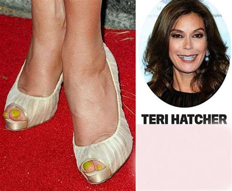 Celebrities With Ugly Feet Pics