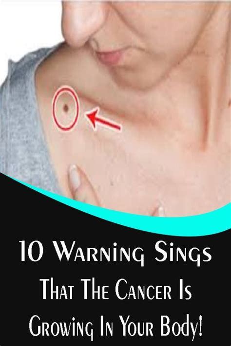 10 Warning Sings That The Cancer Is Growing In Your Body In 2020 With