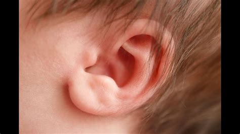 Askthemayomom Discussing Congenital Ear Anomalies Or Malformations