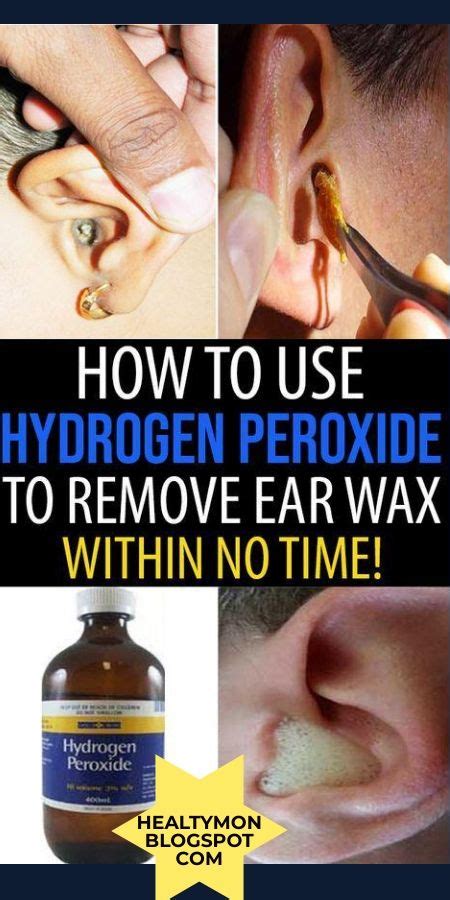 Before you learn how to clean your ears with hydrogen peroxide, you need to find out under what diseases this substance can be used.peroxide works excellently against all inflammatory diseases caused by various pathogens: How To Use Hydrogen Peroxide To Remove Ear Wax? | Ear ...
