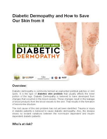 Ppt Diabetic Dermopathy And How To Save Our Skin From It Powerpoint Presentation Free To