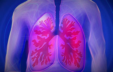 Idiopathic Pulmonary Fibrosis Ipf Phmg P And Other Disinfectant