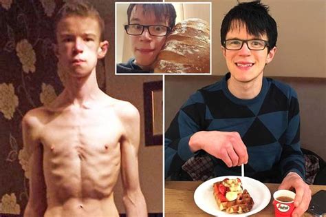 Five Stone Mum Of Two Who Battled Anorexia For Almost Two Decades