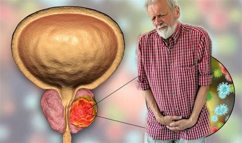 Prostate Cancer Symptoms Signs Include Difficulty Passing Urine Express Co Uk