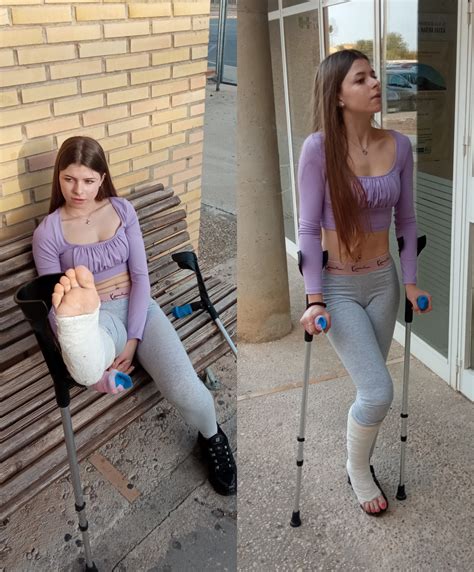 Crutchingaround Casts Braces Sprain Crutches Wheelchair