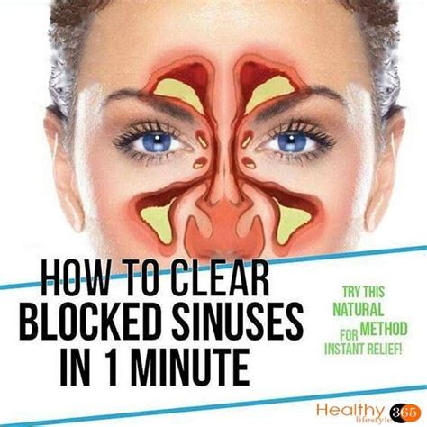 Quick Way To Clear Up Sinuses Anna Blog