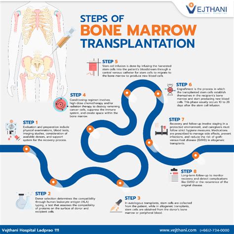 Steps Of Bone Marrow Transplantation Vejthani Hospital Jci
