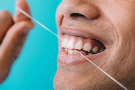 Benefits of Flossing Daily | Humble TX | Lovett Dental Humble
