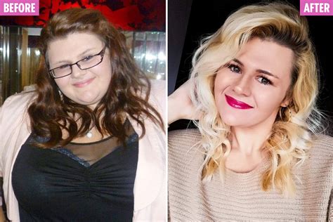 Weight Loss Size 32 Woman Sheds Staggering 10st And Looks Like A Totally Different Person The