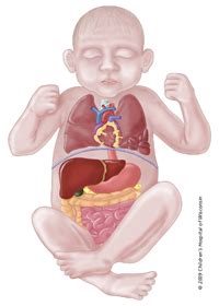 Cpam is listed in the world's largest and most authoritative dictionary database of abbreviations and acronyms. Congenital pulmonary airway malformation (CPAM) | Children ...