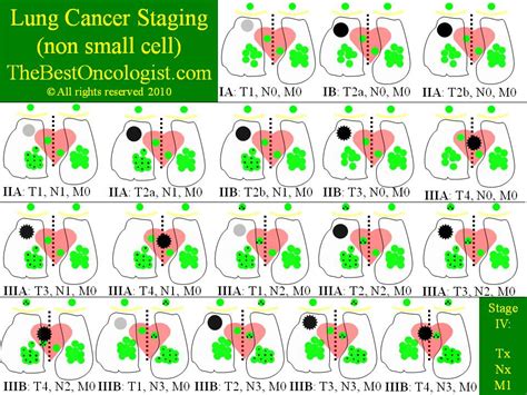 Staging Of Lung Cancer The Best Oncologist Tm