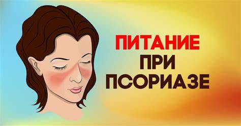 Диета при псориазе - Со Вкусом Картинка - Диета при псориазе - Со Вкусом