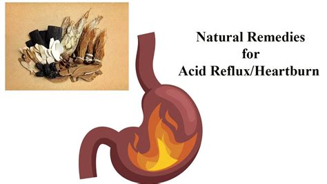 Natural Remedies For Heartburn Youtube