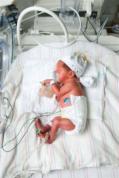 The Truth About What Its Like To Have A Preemie Baby Premature Baby