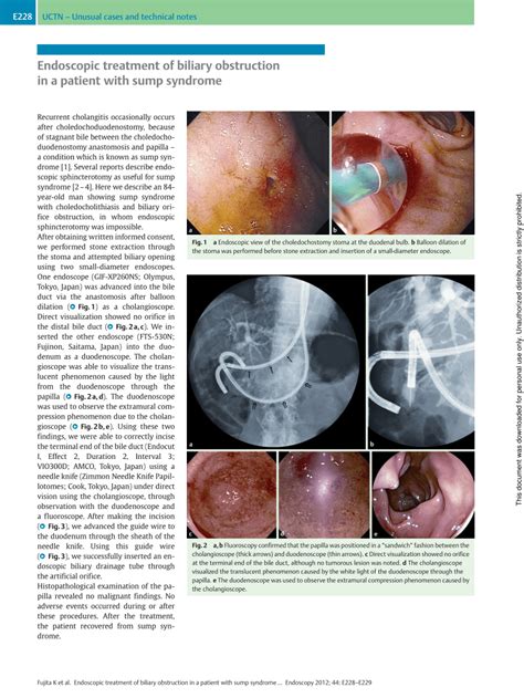 Pdf Endoscopic Treatment Of Biliary Obstruction In A Patient With