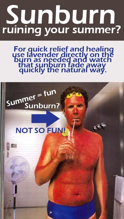 How To Get Ride Of A Sunburn Quick And Natural Summer Saver Burn