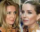 Everything We Know About Annabelle Wallis’ Nose Job