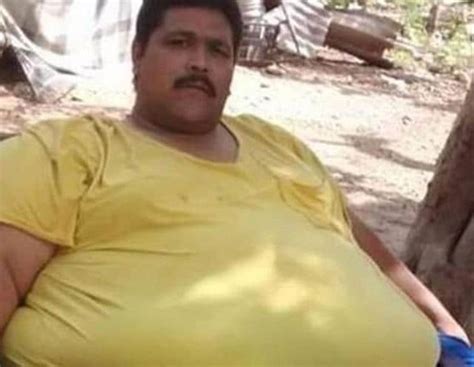 world s most obese man dies after weight loss surgery world news hindustan times