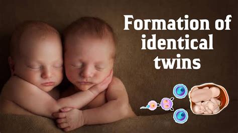 How Identical Twins Are Formed Monozygotic Twins And Conjoined Twins In Hindi Youtube