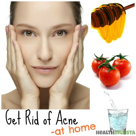 Get Rid Of Acne At Home Using Natural Remedies And Good Habits Hubpages
