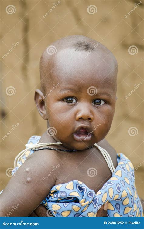 African Baby Editorial Photography Image Of Africa Education 24881252