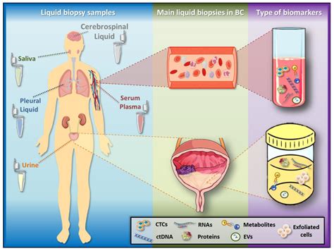 Ijms Free Full Text Liquid Biopsy Biomarkers In Bladder Cancer A