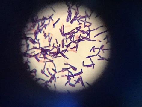 Bacillus Cereus Gram Stain