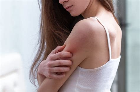 6 Early Signs And Symptoms Of Lupus You Should Never Ignore
